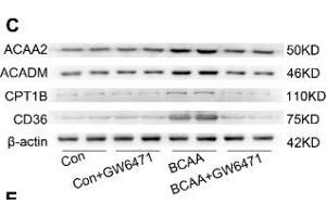 BCAA upregulate PPAR-α and PPAR-α targeted genes. (Medium-Chain Specific Acyl-CoA Dehydrogenase, Mitochondrial (MCAD) (AA 1-220) Antikörper)