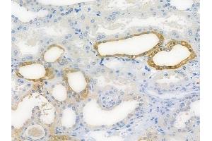 ABIN7096366 and ABIN7100429 at 1/100 staining human normal kidney tissue by IHC-P. (SCYL1 Antikörper)