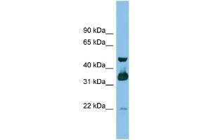 WB Suggested Anti-GBL Antibody Titration: 0. (GBL Antikörper  (Middle Region))