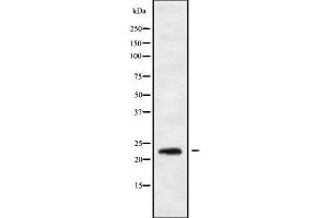 Western blot analysis of RAB30 using K562 whole cell lysates