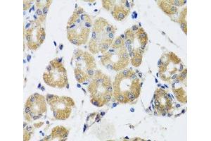 Immunohistochemistry of paraffin-embedded Human stomach using RAD51C Polyclonal Antibody at dilution of 1:100 (40x lens). (RAD51C Antikörper)