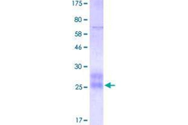 TNFRSF19 Protein (AA 30-170) (His-DYKDDDDK-Strep II Tag)