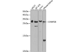 Western blot analysis of extracts of various cell lines, using CHMP2B antibody (ABIN6131571, ABIN6138545, ABIN6138547 and ABIN6217398) at 1:1000 dilution. (CHMP2B Antikörper  (AA 1-213))