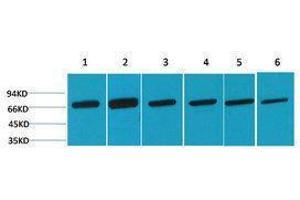 Western Blotting (WB) image for anti-Heat Shock 70kDa Protein 8 (HSPA8) antibody (ABIN3179025) (Hsc70 Antikörper)