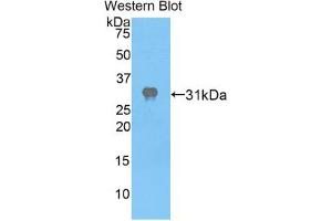 Western blot analysis of the recombinant protein. (APAF1 Antikörper  (AA 872-1135))