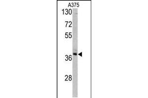 Western blot analysis of TALDO1 antibody in A375 cell line lysates (35ug/lane)