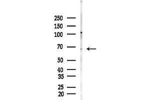 anti-Protein Phosphatase 2, Regulatory Subunit A, beta (PPP2R1B) (C-Term) antibody