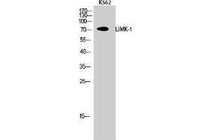 Western Blotting (WB) image for anti-LIM Domain Kinase 1 (LIMK1) (Internal Region) antibody (ABIN6284007)