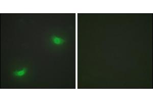 Immunofluorescence analysis of HepG2 cells, using DUSP16 antibody. (DUSP16 Antikörper)