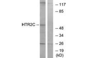 Western Blotting (WB) image for anti-5-Hydroxytryptamine (serotonin) Receptor 2C (HTR2C) (AA 395-444) antibody (ABIN2890745) (HTR2C Antikörper  (AA 395-444))