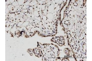 Immunoperoxidase of monoclonal antibody to H2AFV on formalin-fixed paraffin-embedded human placenta. (H2AFV Antikörper  (AA 1-128))