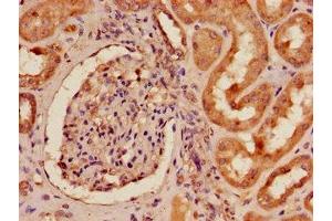 Immunohistochemistry of paraffin-embedded human kidney tissue using ABIN7151839 at dilution of 1:100 (EPH Receptor A4 Antikörper  (AA 345-545))