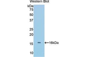 Western blot analysis of the recombinant protein. (BMP5 Antikörper  (AA 201-314))