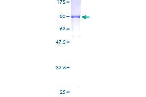 Image no. 1 for G Protein-Coupled Receptor Kinase Interactor 2 (GIT2) (AA 1-471) protein (GST tag) (ABIN1355123) (GIT2 Protein (AA 1-471) (GST tag))