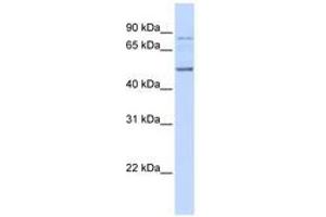 Image no. 1 for anti-Amyotrophic Lateral Sclerosis 2 (Juvenile) Chromosome Region, Candidate 12 (ALS2CR12) (AA 36-85) antibody (ABIN6741155) (ALS2CR12 Antikörper  (AA 36-85))