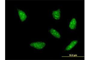 Immunofluorescence of monoclonal antibody to HOXA5 on HeLa cell. (HOXA5 Antikörper  (AA 171-270))