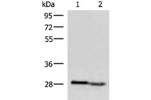 Western blot analysis of Human fetal intestines tissue and Human fetal liver tissue lysates using KLRB1 Polyclonal Antibody at dilution of 1:800 (CD161 Antikörper)