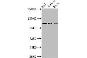 Western Blot Positive WB detected in: 293 whole cell lysate, Jurkat whole cell lysate, Hela whole cell lysate All lanes: NEDD4L antibody at 3 μg/mL Secondary Goat polyclonal to rabbit IgG at 1/50000 dilution Predicted band size: 112, 105, 101, 99, 111, 110, 97 kDa Observed band size: 112 kDa (NEDD4-2 Antikörper  (AA 289-494))