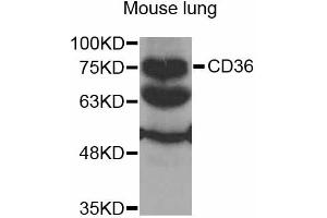 Western blot analysis of extracts of mouse lung, using CD36 antibody (ABIN2561720) at 1:1000 dilution. (CD36 Antikörper)