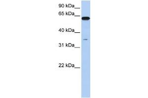 WB Suggested Anti-KPNA6 Antibody Titration: 0. (KPNA6 Antikörper  (N-Term))