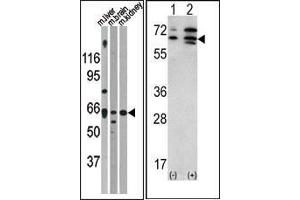 (LEFT)Western blot analysis of anti-ACVR2A Antibody (N-term) in mouse liver brain and kidney tissue lysates (35ug/lane).