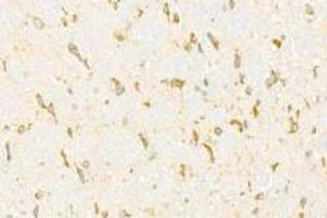 Immunohistochemistry analysis of paraffin-embedded mouse cerebellum using ADAMTS4 (ABIN7072947) at dilution of 1: 500