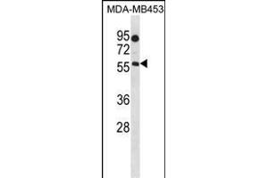 B4GALNT1 Antibody (Center) (ABIN1538263 and ABIN2849848) western blot analysis in MDA-M cell line lysates (35 μg/lane). (B4GALNT1 Antikörper  (AA 296-323))