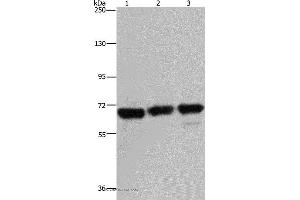 Western blot analysis of 293T, Jurkat and Hela cell, using PCK2 Polyclonal Antibody at dilution of 1:750 (PEPCK Antikörper)