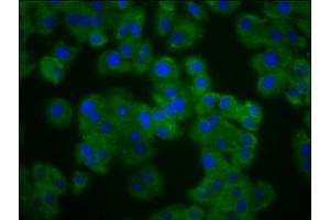 Immunofluorescence staining of HepG2 cells with ABIN7162591 at 1:133, counter-stained with DAPI. (Pannexin 3 Antikörper  (AA 135-215))