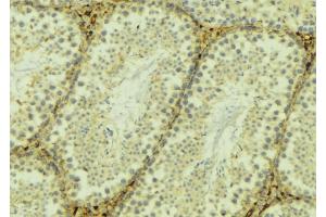 ABIN6268946 at 1/100 staining Mouse testis tissue by IHC-P. (TXNRD2 Antikörper  (C-Term))