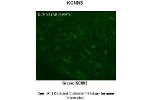 Sample Type :  Rhesus macaque spinal cord  Primary Antibody Dilution :  1:300  Secondary Antibody :  Donkey anti Rabbit 488  Secondary Antibody Dilution :  1:500  Color/Signal Descriptions :  Green: KCNN3  Gene Name :  KCNN3  Submitted by :  Timur Mavlyutov, Ph.