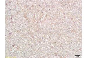 Formalin-fixed and paraffin embedded rat brain tissue with labeled Anti-CD38 Polyclonal Antibody, Unconjugated  at 1:200, followed by conjugation to the secondary antibody and DAB staining (CD38 Antikörper  (AA 101-200))