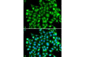 Immunofluorescence analysis of MCF-7 cells using SUFU antibody (ABIN6133029, ABIN6148692, ABIN6148694 and ABIN6217424). (SUFUH Antikörper  (AA 325-484))