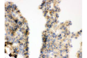 Immunohistochemistry (IHC) image for anti-Catechol-O-Methyltransferase (COMT) (AA 52-271) antibody (ABIN3043815)