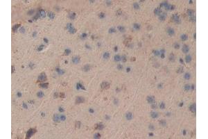 Immunohistochemistry (IHC) image for anti-Dihydrolipoamide Dehydrogenase (DLD) (AA 45-271) antibody (ABIN7432892)