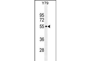 CCDC97 Antibody (C-term) (ABIN655301 and ABIN2844887) western blot analysis in Y79 cell line lysates (35 μg/lane). (CCDC97 Antikörper  (C-Term))