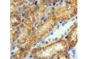 Immunohistochemistry (IHC) image for anti-Dihydrolipoamide Dehydrogenase (DLD) (AA 280-487) antibody (ABIN1858650)