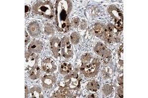 Immunohistochemical staining of human breast with MUCL1 polyclonal antibody  shows moderate cytoplasmic and extracellular positivity in glandular cells at 1:20-1:50 dilution.