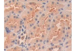 Immunohistochemistry (IHC) image for anti-Oncoprotein Induced Transcript 3 (OIT3) (AA 297-506) antibody (ABIN7434002)