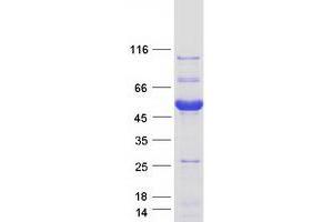 Western Blotting (WB) image for AKT1 Substrate 1 (Proline-Rich) (AKT1S1) (Transcript Variant 1) protein (Myc-DYKDDDDK Tag) (ABIN2714516)