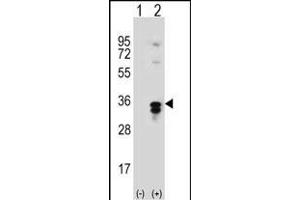Western blot analysis of T1 (arrow) using rabbit polyclonal T1 Antibody  (ABIN389117 and ABIN2839303).