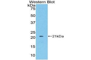 Western Blotting (WB) image for anti-Protein S (PROS) (AA 481-667) antibody (ABIN1860323) (PROS1 Antikörper  (AA 481-667))