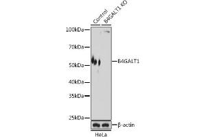 Western Blotting (WB) image for anti-UDP-Gal:betaGlcNAc beta 1,4 Galactosyltransferase, Polypeptide 1 (B4GALT1) (AA 50-215) antibody (ABIN6137403)