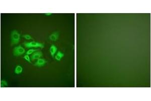 Immunofluorescence analysis of A549 cells, using Keratin 10 Antibody. (Keratin 10 Antikörper  (AA 136-185))