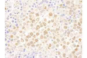 Immunohistochemistry (IHC) image for anti-DEAD (Asp-Glu-Ala-Asp) Box Polypeptide 27 (DDX27) (AA 700-750) antibody (ABIN7448950) (DDX27 Antikörper  (AA 700-750))