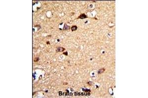 Formalin-fixed and paraffin-embedded human brain tissue with UNC5C Antibody (Center), which was peroxidase-conjugated to the secondary antibody, followed by DAB staining. (Unc5c Antikörper  (AA 188-217))