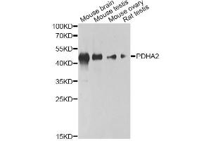 Western blot analysis of extracts of various cell lines, using PDHA2 antibody (ABIN6293728) at 1:1000 dilution. (PDHA2 Antikörper)