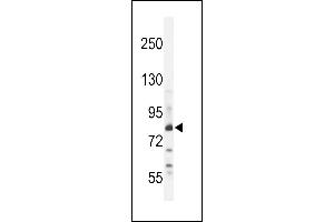 Z Antibody (N-term) (ABIN654759 and ABIN2844443) western blot analysis in WiDr cell line lysates (35 μg/lane). (ZNF180 Antikörper  (N-Term))