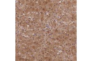 Immunohistochemical staining of human liver with SLC25A41 polyclonal antibody  shows moderate cytoplasmic and nuclear positivity in hepatocytes at 1:50-1:200 dilution. (SLC25A41 Antikörper)