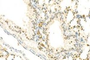 Immunohistochemistry analysis of paraffin-embedded mouse lung using,IOP2 (ABIN7074883) at dilution of 1: 2000 (NARF Antikörper)